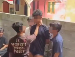 Korban Perundungan di Binus, Alami Luka di Wajah