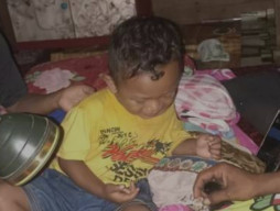 Balita Diserang Harimau saat Tidur