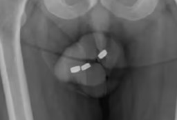 Demi Kepuasan Seksual, Kakek 73 Tahun Masukkan 3 Batre ke Dalam Penis