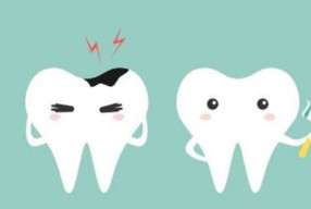 Penyebab Gigi Berlubang, dari Gula hingga Gaya Hidup