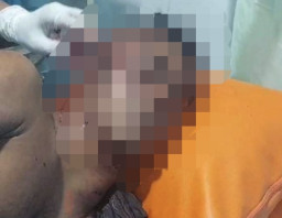 Memanen Cabai, Pria Ini Diserang Harimau hingga Kritis