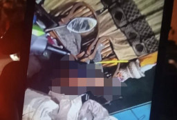 Asyik Video Call dengan Sang Anak, Kakek 82 Tahun Dibacok Perampok