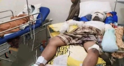 Paman dan Keponakan Terbakar Kena Ledakan Petasan