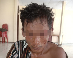 Cemburu, Pria Ini Bacok Mantan Istri Sirinya dengan Pasangan Barunya