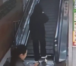 Terperosok di Eskalator, Kaki Wanita Ini Terancam Diamputasi