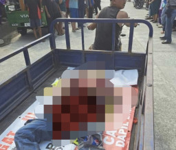 Buruh Pabrik Nekad Gorok Leher Sendiri tapi Tidak Meninggal