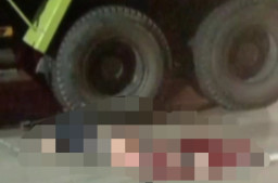 Dilindas Truk, Kaki Pria Ini Remuk