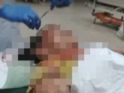 Hendak Cuci Beras, Emak-Emak Diseret Buaya