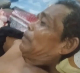 Sedang Wudhu, Tangan Digigit Buaya