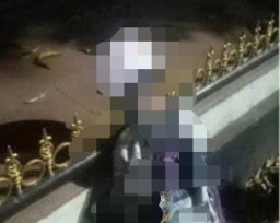 Terpeleset saat Buang Air Kecil, Kepala Pria Ini Tertancap Pagar