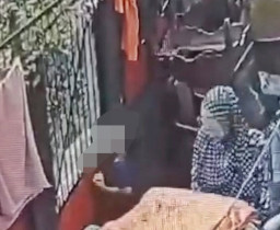 Seorang Bocah di Cipulir Jakarta Digigit Anjing, Syaraf Air Mata Diduga Putus