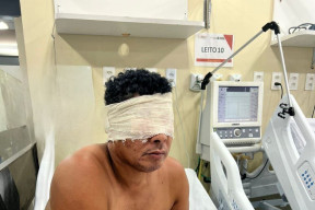 Menderita Skizofrenia, Pria Ini Congkel Mata Sendiri