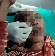 Terjadi Perampokan di Kampung Teleng,  Uang Dirampas dan Wajah Korban Penuh Luka