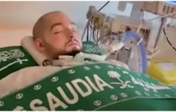 Berkaca dari Kasus Sleeping Prince Arab yang Koma 19 Tahun, Waspadai Pendarahan Otak