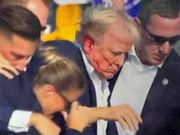 Ditembak saat Kampanye, Telinga Donald Trump Berdarah-darah