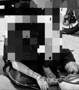 Tabrak Mobil yang Berhenti di Bahu Jalan, Pengendara Vario Alami Luka di Wajah