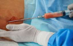 Sedot Lemak Bisa Mematikan, Ini Sebabnya