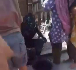 Merokok Sambil Salin Bensin, Pria Ini Hangus Terbakar