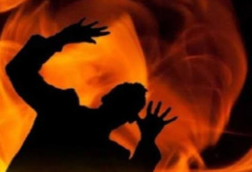 Ikut Karnaval, 5 Orang Berkostum Shaun The Sheep Terbakar Akibat Percikan Kembang Api