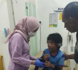 Dianiaya Sang Ayah, Anak Ini Dikunjungi Pj Bupati