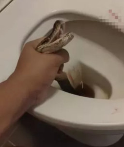 Asyik Buang Air Besar, Alat Kelamin Pria Ini Digigit Ular Piton