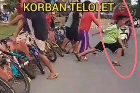 Cegat Telolet, Bocah Ditabrak Motor hingga Kakinya Patah