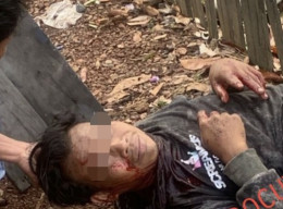 Berkelahi dengan Tetangga Sendiri, Pria Ini Sekarat