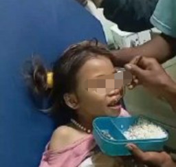 Viral! Detik-Detik Anak Sebelum Meninggal usai Digigit Anjing Peliharaannya