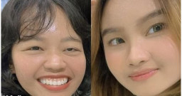 Dua Wanita Indonesia Meninggal Akibat Kecelakaan di Australia