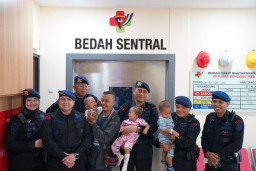 Jadi Kegiatan Rutin, RS Bhayangkara Brimob Depok Laksanakan Operasi Bibir Sumbing