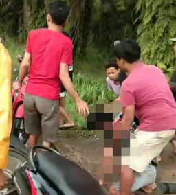Balap Liar Berakhir Tragis, Pemotor Alami Luka Parah di Wajah