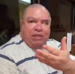 Berdarah-darah, Razman Nasution Ngaku Dianiaya Nikita Mirzani