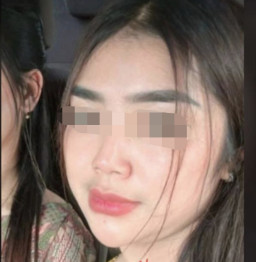 Sebelum Dimutilasi, Uswatun Diduga Alami Banyak Kekerasan