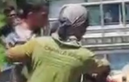 Jatuh karena Jalan Berlubang, Kaki Pemotor Terlindas Truk