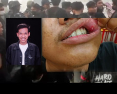 Ketua KKJT: Stop Kekerasan terhadap Jurnalis