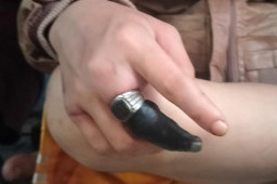 Jari Warga Depok Menghitam Gegara Tersangkut Cincin, Damkar Evakuasi Selama 2 Jam