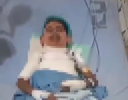 Siswa SD Diduga Dibakar Temannya di Situbondo