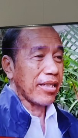 Viral Wajah Jokowi Penuh Bercak Hitam dan Rambut Rontok, dr.Tifa: Seperti Kena Autoimun