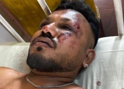 Kecelakaan Pesawat Air India, 265 Orang Tewas dan 1 Selamat dengan Cidera Ringan