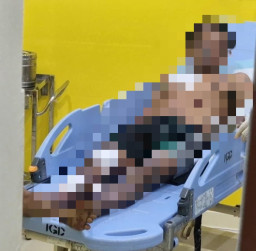 Amankan Balon Udara, Pria di Ponorogo Terkena Ledakan Petasan