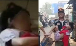 NASIB Pilu Bocah 7 Tahun Kurus Kering Dibuang Orangtua, Ngaku Disiksa Ayah, Wajahnya Melepuh