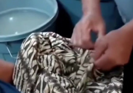 Kepala Bayi Lepas saat Persalinan di Puskesmas, Keluarga Laporkan Dugaan Malpraktek