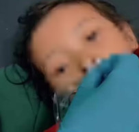 Kisah Tragis Raya, Balita 4 Tahun yang Kalah Melawan Ribuan Cacing