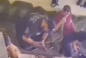 Nongkrong Santai, Pemuda Ini Tak Sengaja Tembak Dadanya Sendiri