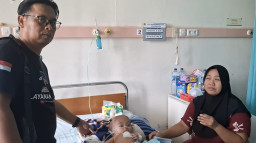 Kasihan! Bayi 7 Bulan Ini Mengalami Pembesaran di Bagian Kepala