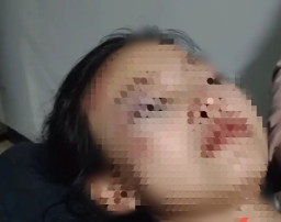 Berangkat Sekolah, Siswi Sekolah Kecelakaan Tunggal hingga Tak Sadarkan Diri