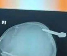 Jadi Korban Penganiayaan,  Kunci Motor Menancap di Kepala Pelajar