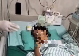 Bocah SD di Boyolali Diduga Jadi Korban Perundungan hingga Kritis