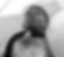 Tabrak Truk dari Belakang, Paru-Paru Pemotor Menyembul Keluar