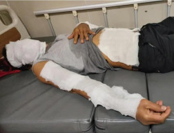 Mesin Pengering di Dapur SPPG Mojokerto Meledak, Dua Pekerja Alami Luka Bakar